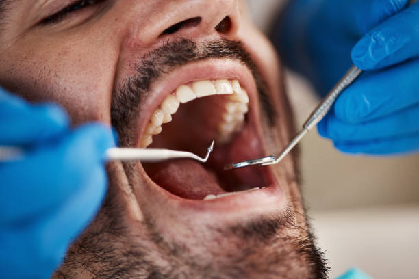 Best Emergency Treatment for Dental Infections or Abscesses in Keego Harbor, MI